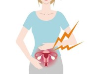 Kenali Endometriosis Pada Wanita