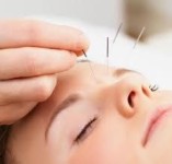 3 Manfaat Botox Wajah dan Efek Sampingnya yang Perlu Kalian Tahu